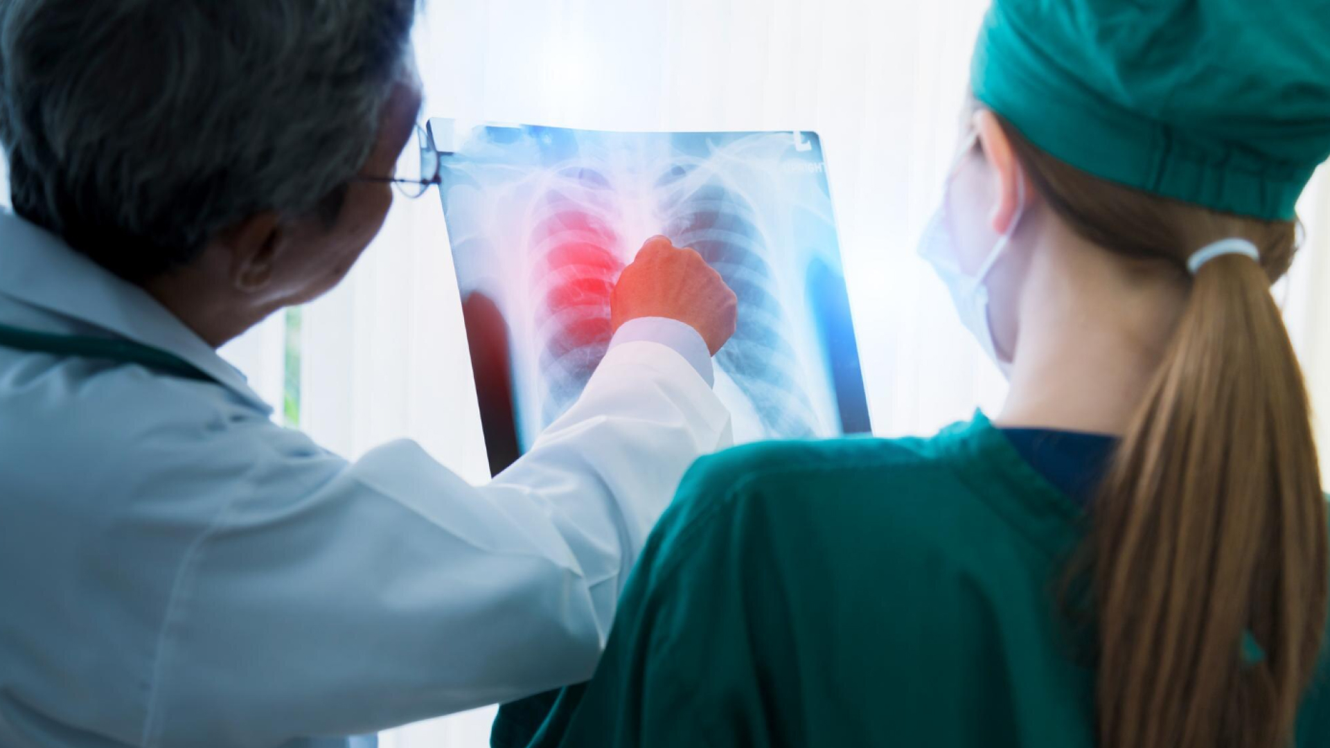 Терапия вирусных пневмоний