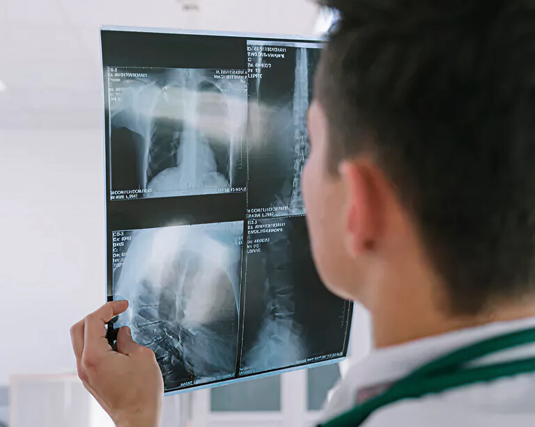 Терапия вирусных пневмоний