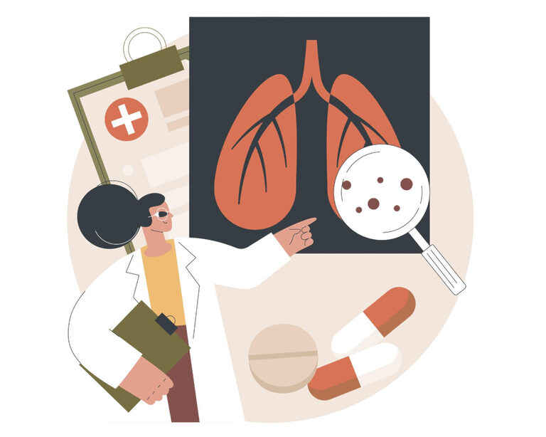 Микоплазменная пневмония в России