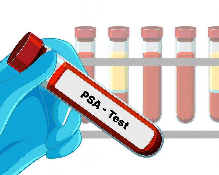 Тест ПСА: щит мужского здоровья