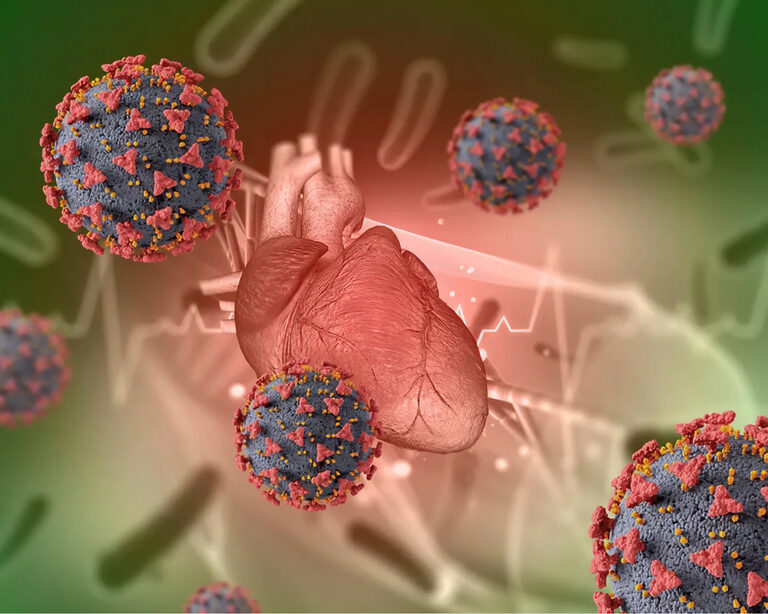 COVID-19 увеличивает риск остановки сердца