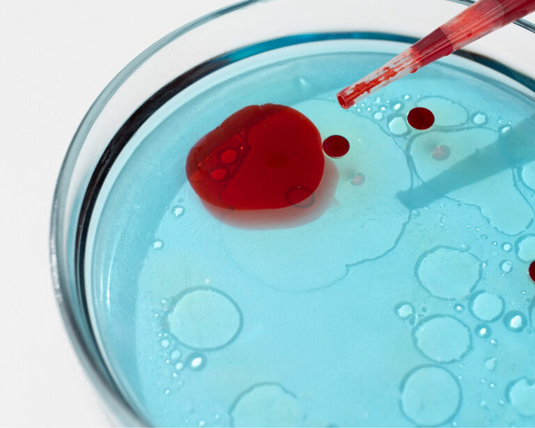 Что такое HbA1c и почему он важен