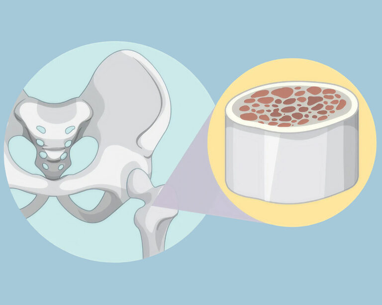 Регенерация костной ткани