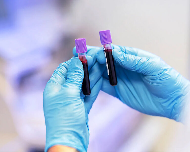 Дуэт гормонов: почему важно определять свободный Т4 вместе с ТТГ