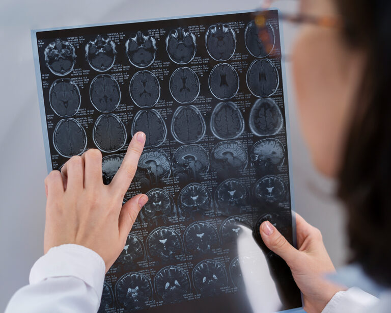 Новый метод лечения опухолей мозга