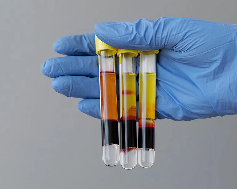 Фундаментальная и клиническая роль сердечных тропонинов I и T