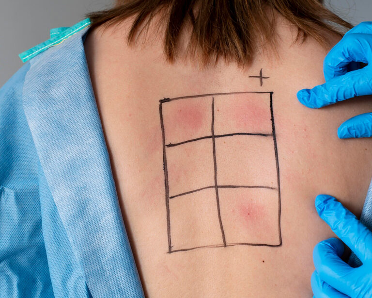 Новые методы диагностики и лечения аллергий