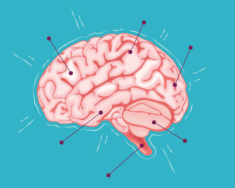 Как распознать инсульт