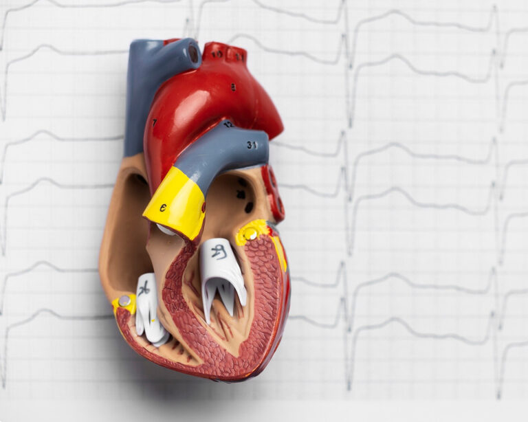 Достижения в кардиологии