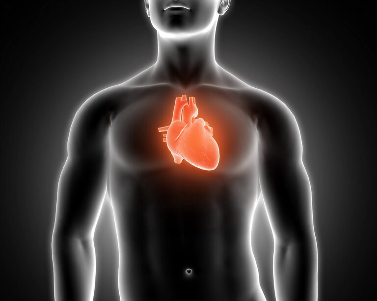 Инфаркты под контролем