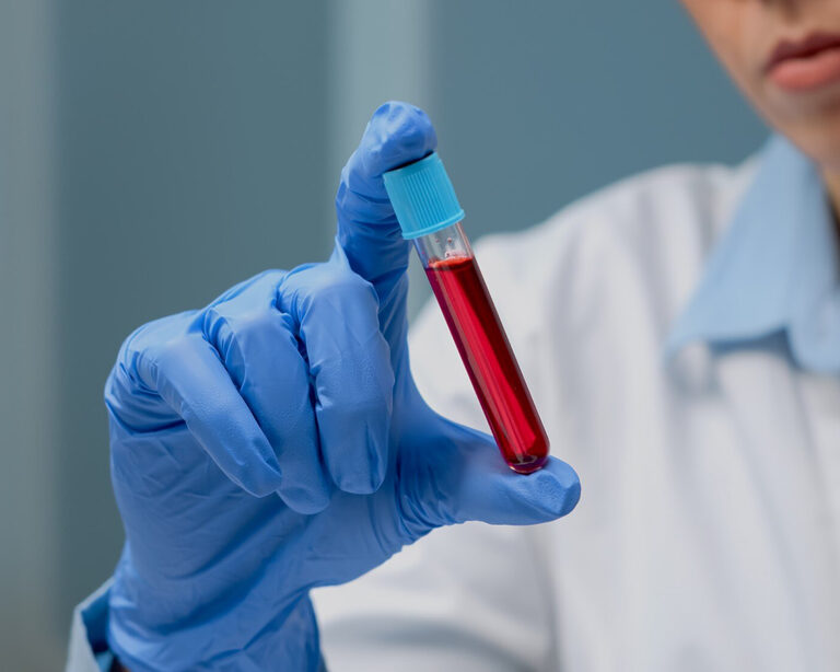 Инфектология и кардиогруппа маркеров