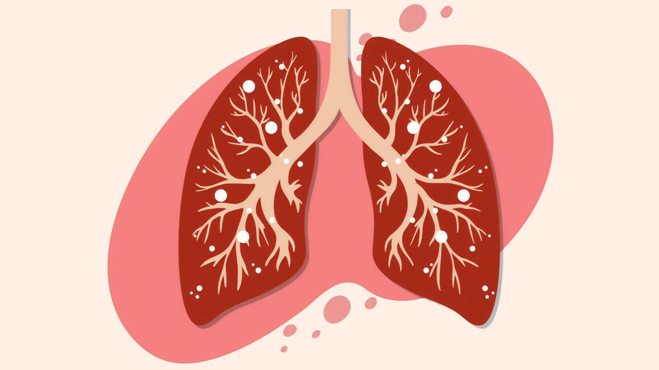Ингаляции водородом
