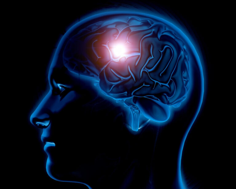 Рак мозга под контролем