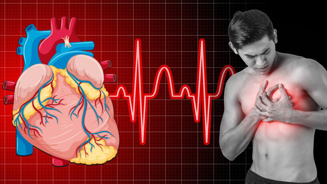 Триумф над инфарктами