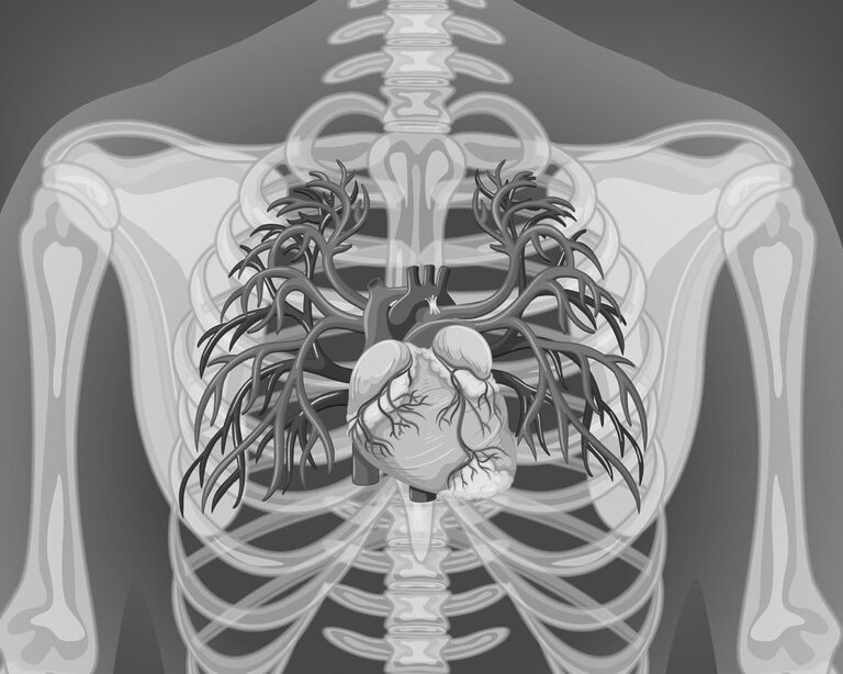 Триумф над инфарктами