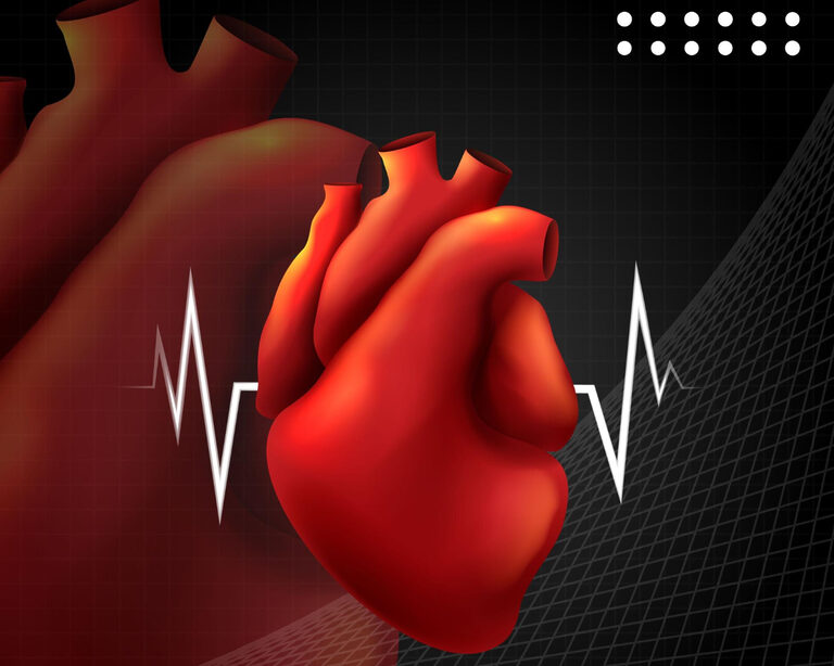 Профилактика инфарктов