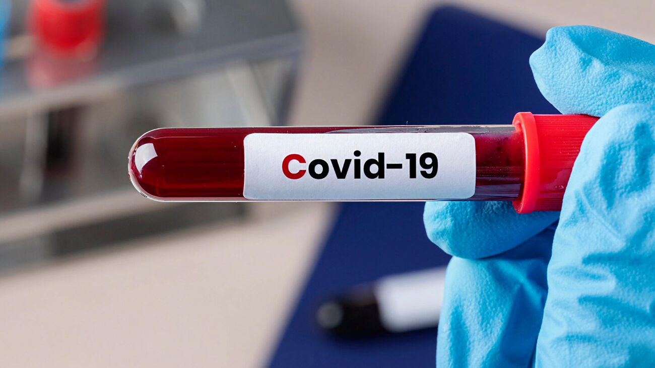 “Стратус” – эволюция “Омикрона”