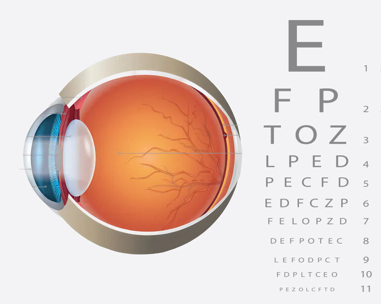 Как сосуды губят зрение