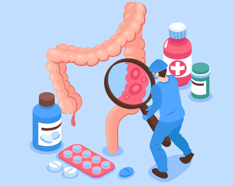 Гастроэзофагеальная рефлюксная болезнь