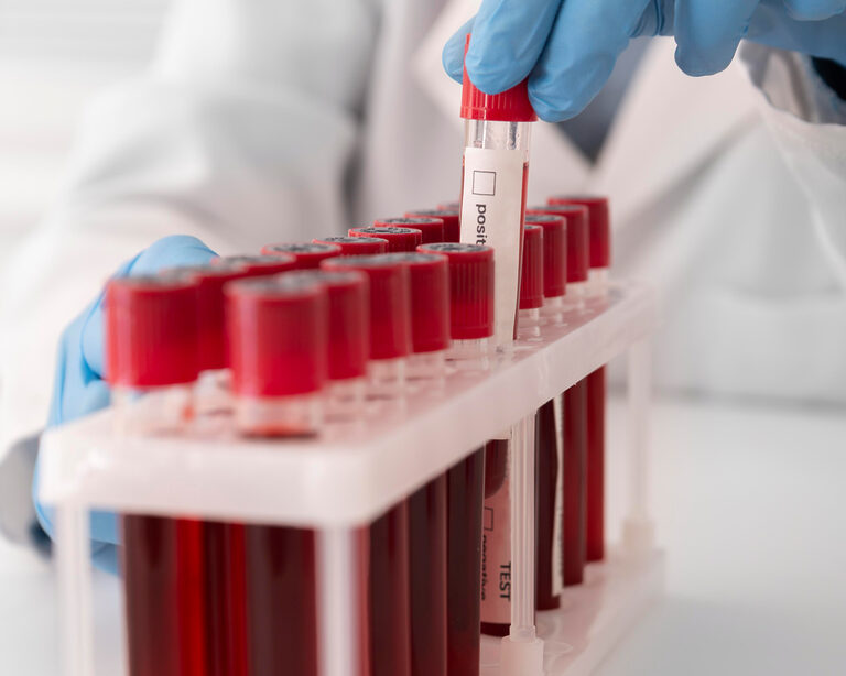 5 главных маркеров здоровья