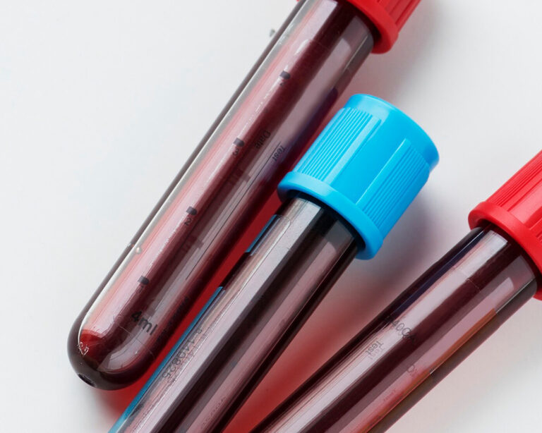 Дефицит витамина D: как определить и восполнить