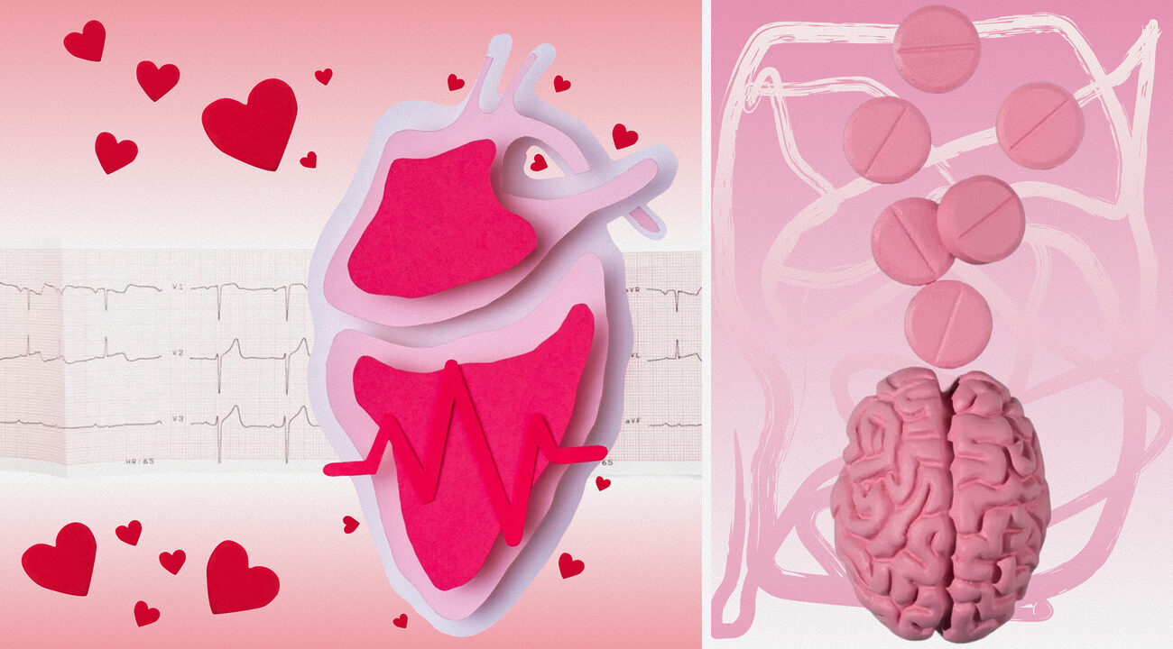 Инфаркт и инсульт: ключевые различия