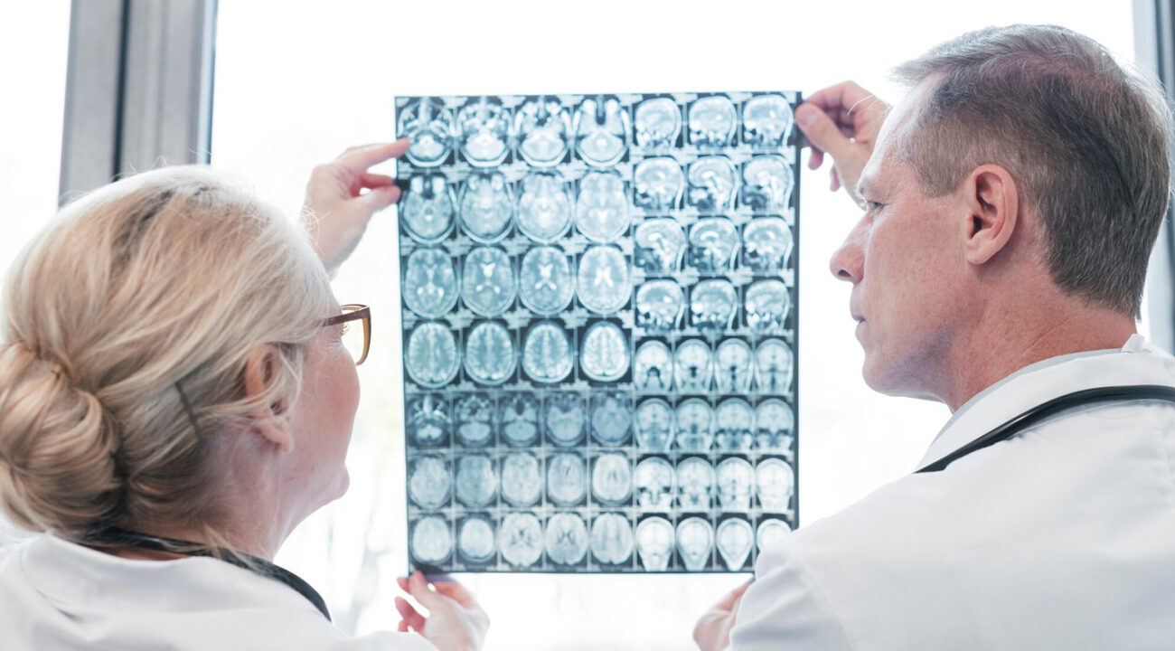 Цереброваскулярные катастрофы