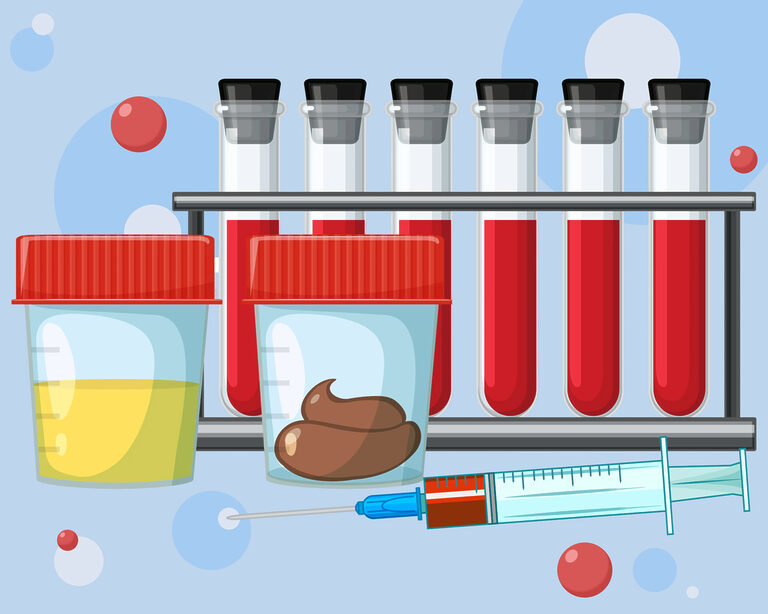 Тесты на скрытую кровь: когда они нужны?