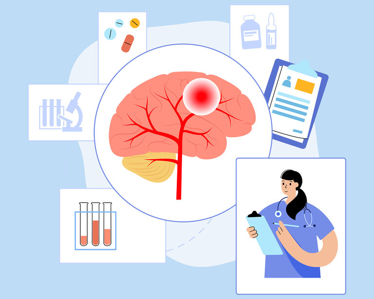 Прогноз инсульта