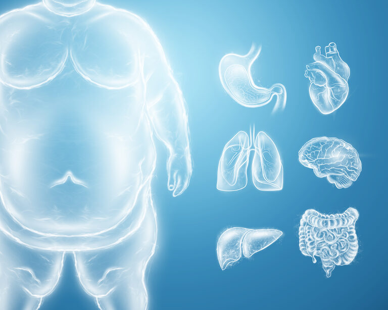 Классификация ожирения