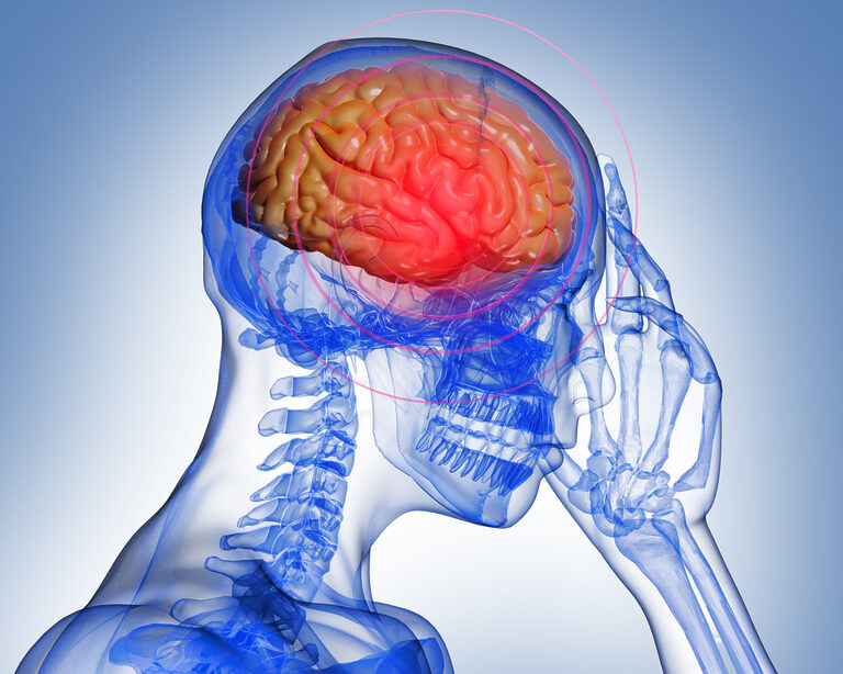 Цереброваскулярная патология