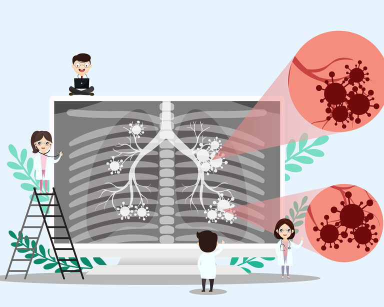 Рак легких: роль инфекций