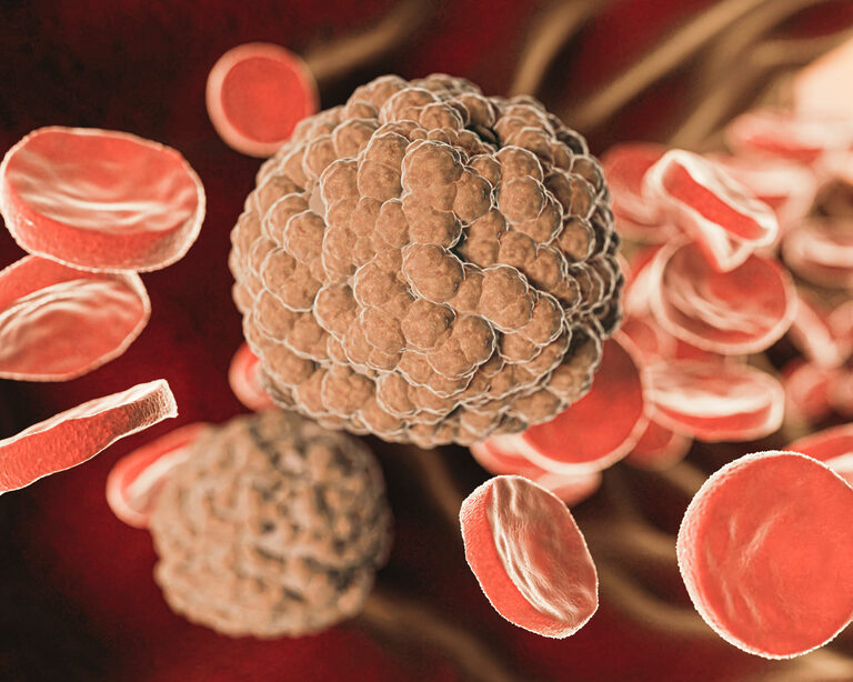 Снижение холестерина ЛПНП