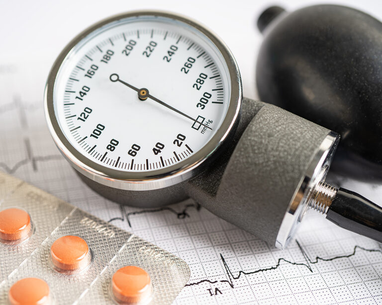 Артериальная гипертензия как триггер инсульта